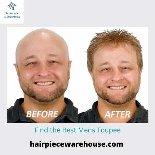 photo of Best Hair Systems for Men With Undetectable Base at 1177 Goldfinch Lane Anne Arundel County MD 21108