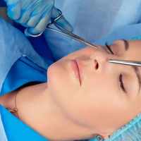 Rhinoplasty 