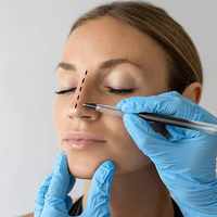 Rhinoplasty cost in Saudi Arabia